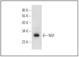 NGF beta Antibody