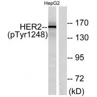 HER2(Phospho-Tyr1248) Antibody