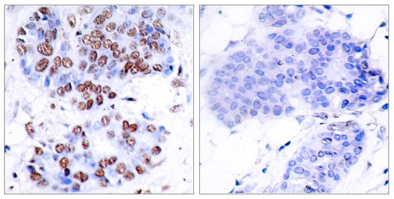 NFkB-p65(Ab-276) Antibody - SAB | Signalway Antibody