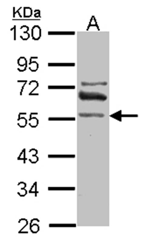 ALDH1A2 antibody