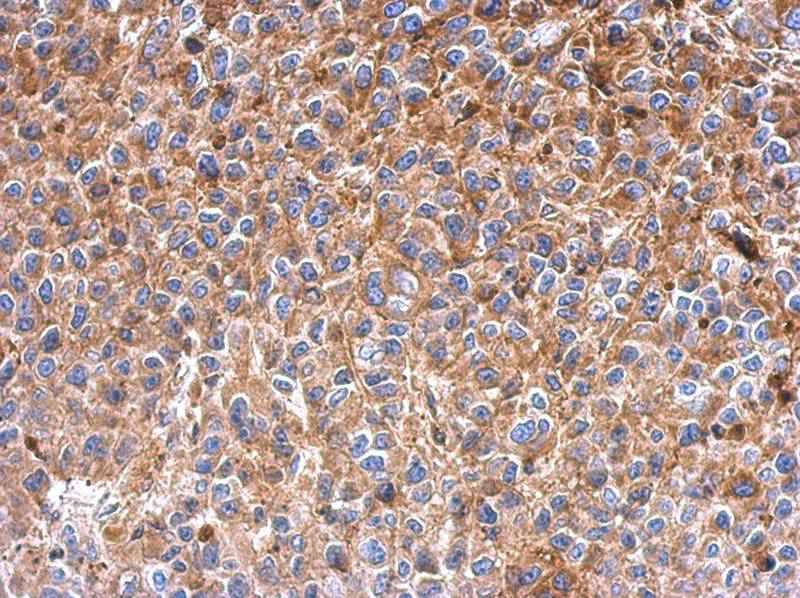 IFIT3 antibody