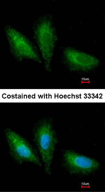 PRKCSH antibody