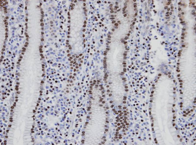 NANS antibody