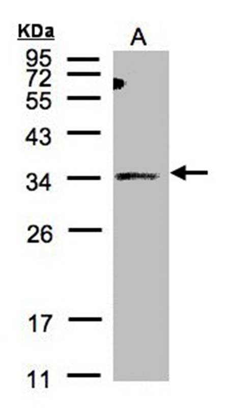 ST3GAL1 antibody