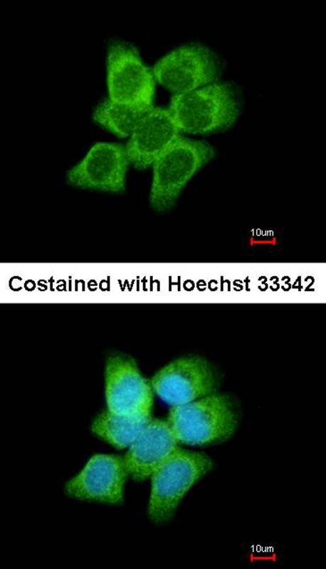 AKR1C1 antibody