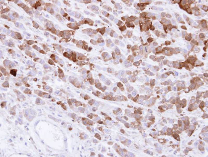 AKR1C1 antibody