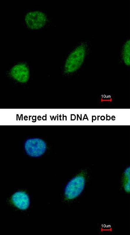 glyoxalase I antibody