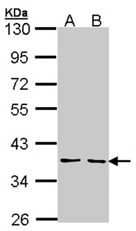 YKL-39 antibody