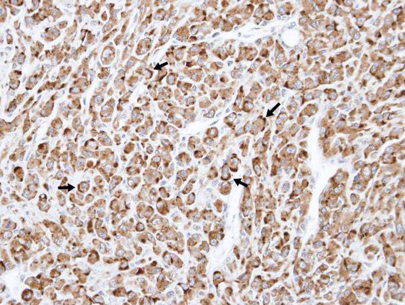 TNFRSF19L antibody