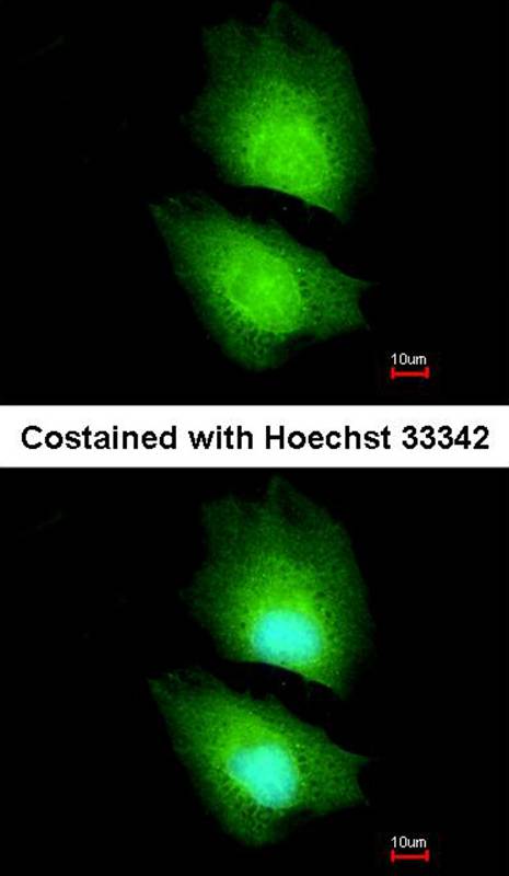 CBS antibody