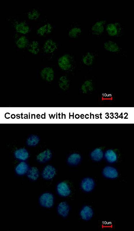 SMC1B antibody