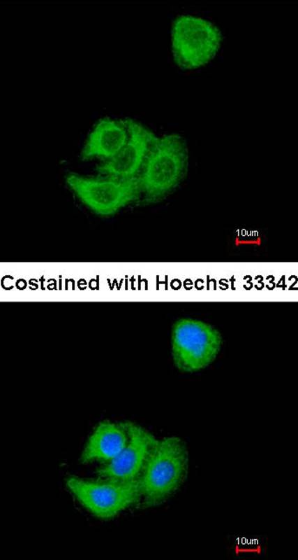 AGR3 antibody