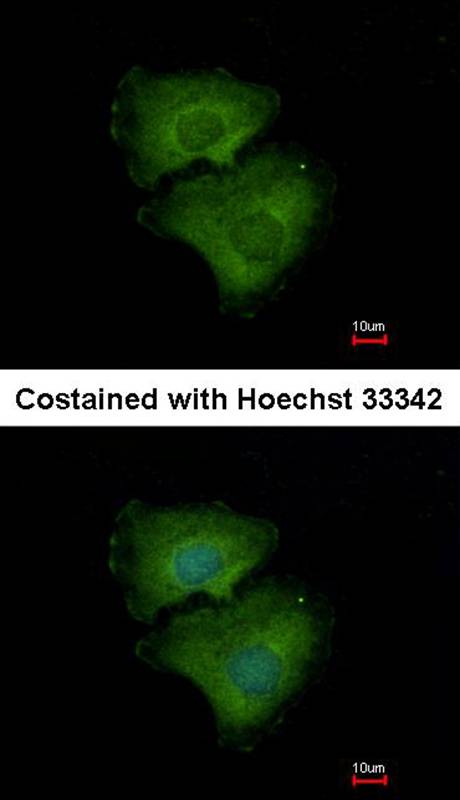 ALPPL2 antibody