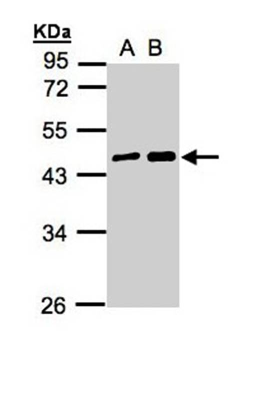 MAGEA11 antibody