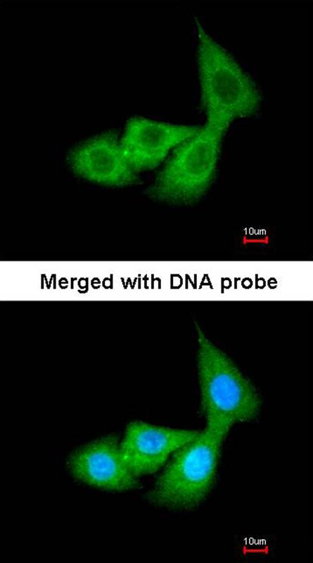 Cortisol Binding Globulin antibody - SAB | Signalway Antibody