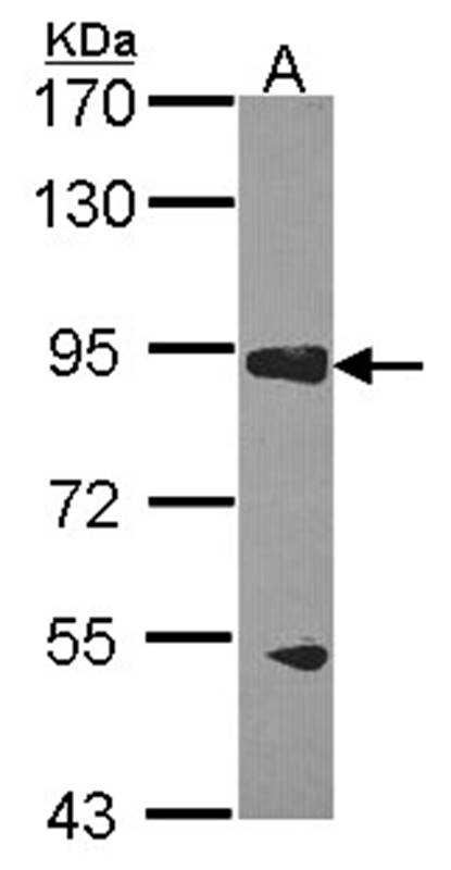 RASA3 antibody