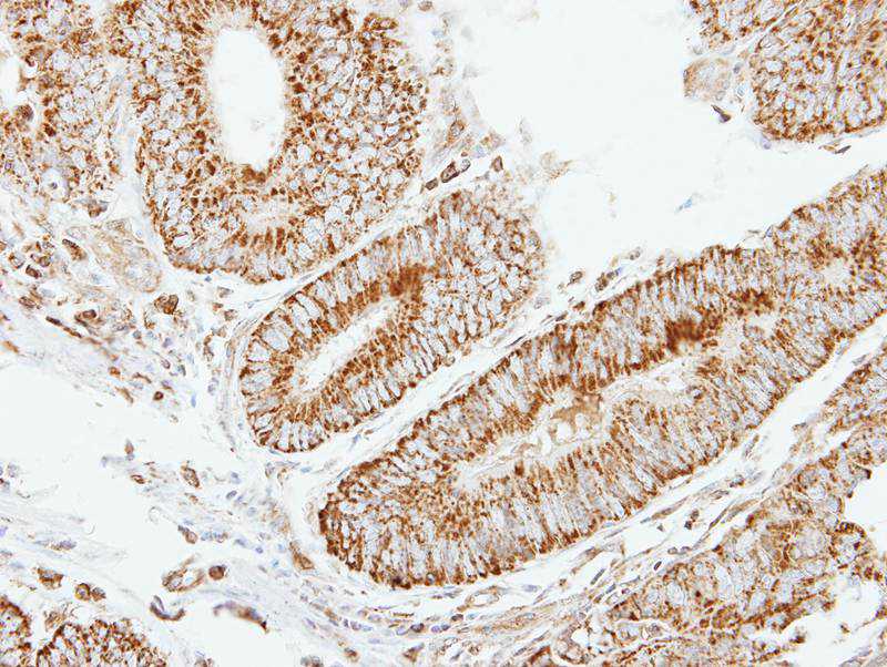 eIF2B beta antibody