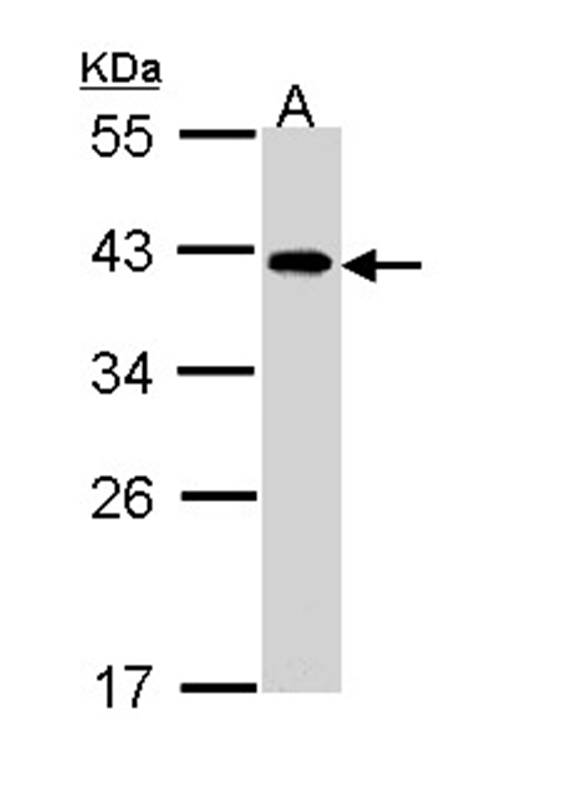 eIF2B beta antibody