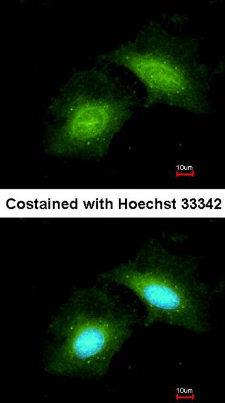 GADD 45 gamma antibody