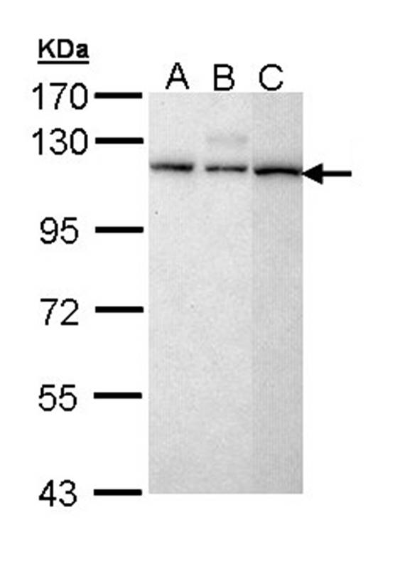 SART1 antibody