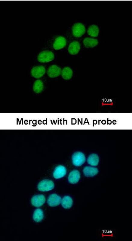 DNA ligase 3 antibody - SAB | Signalway Antibody