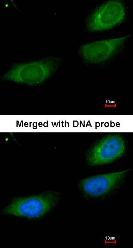 Fibrinogen gamma antibody