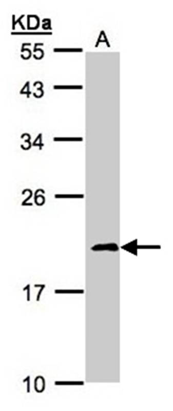 NDUFS4 antibody - SAB | Signalway Antibody