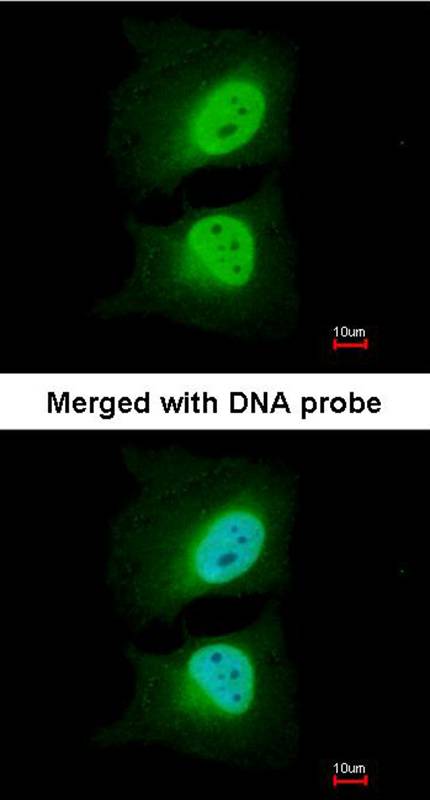 CSE1L antibody