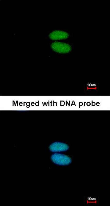 alpha Actinin 4 antibody