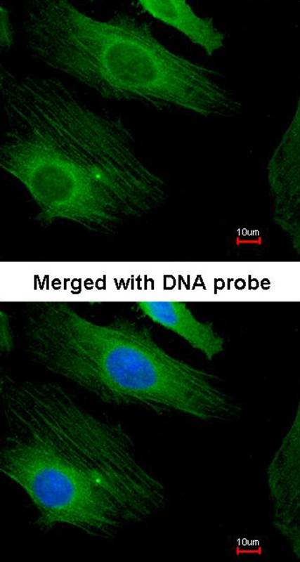 H-Ras antibody