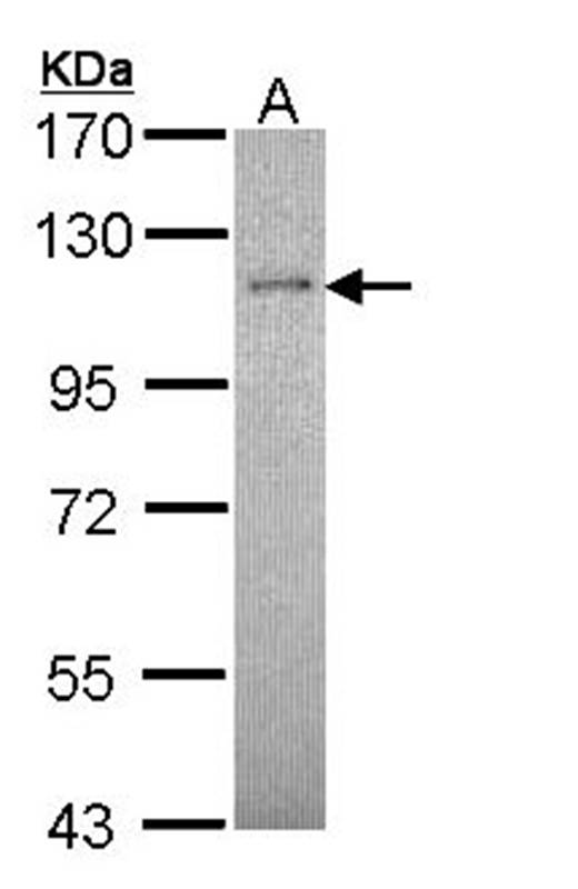 CtIP antibody