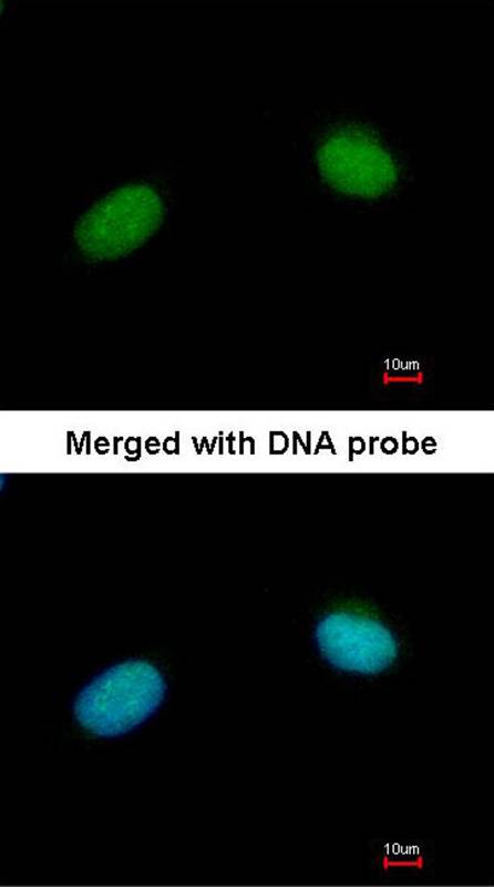 XRCC3 antibody