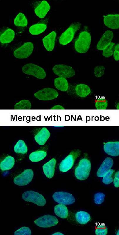 VCP(p97) antibody