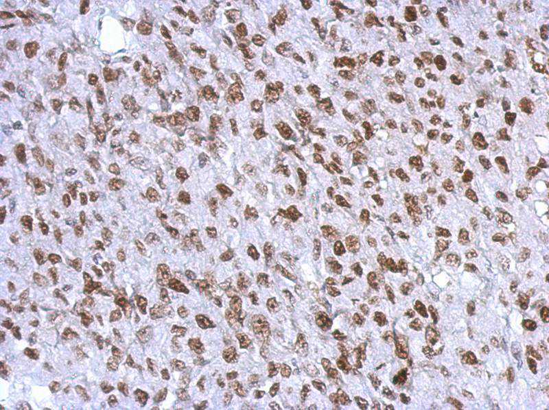 WT1 antibody