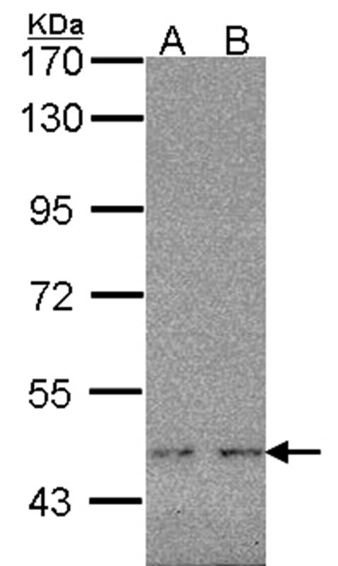 WT1 antibody