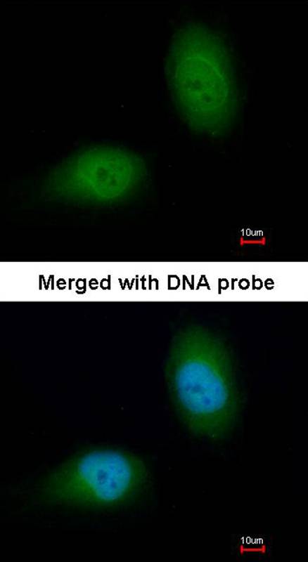 HSPB8 antibody