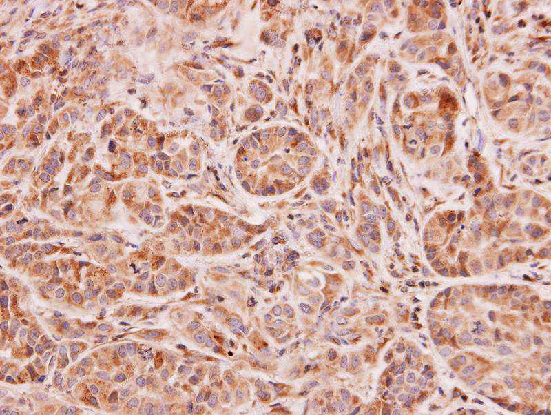 NAT2 antibody