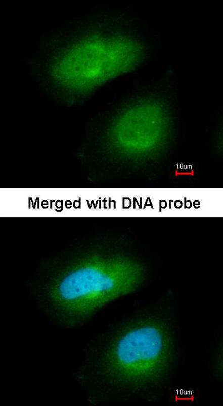 PRAK antibody