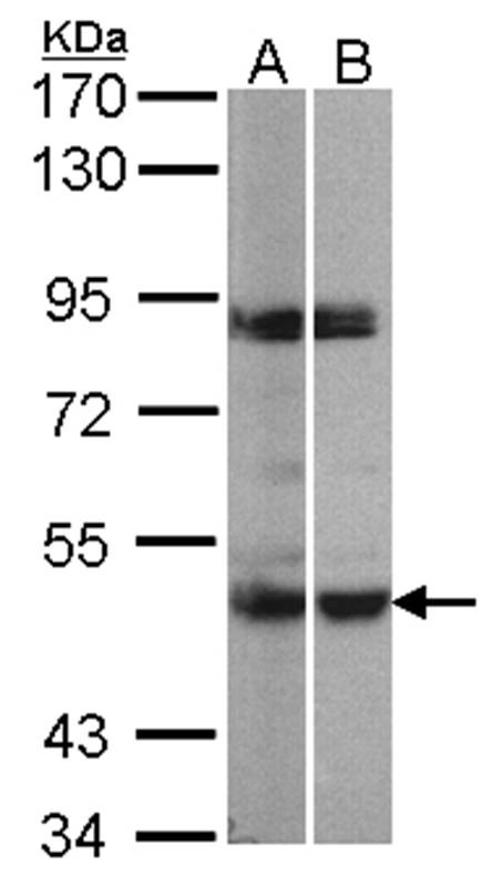 PRAK antibody