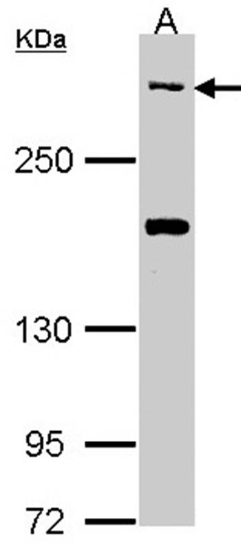 CACNA1B antibody - SAB | Signalway Antibody