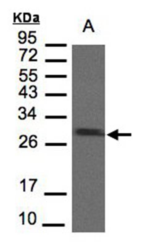 SDHB antibody - SAB | Signalway Antibody