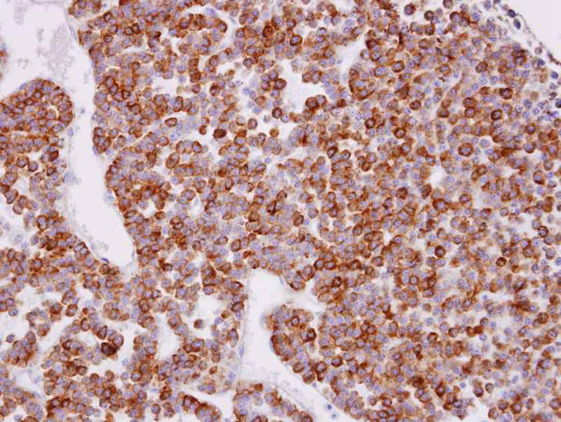 XPR1 antibody - SAB | Signalway Antibody