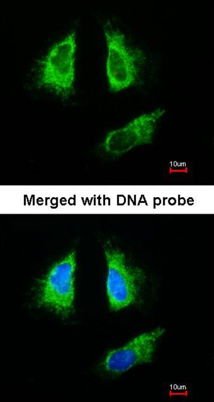 14-3-3 beta antibody