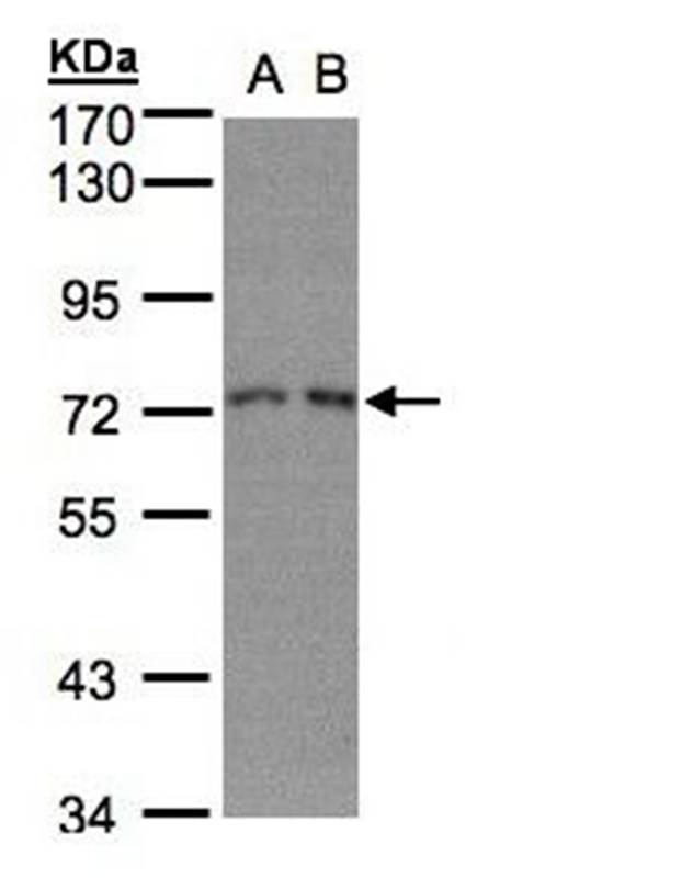 RPA 70 kDa subunit antibody