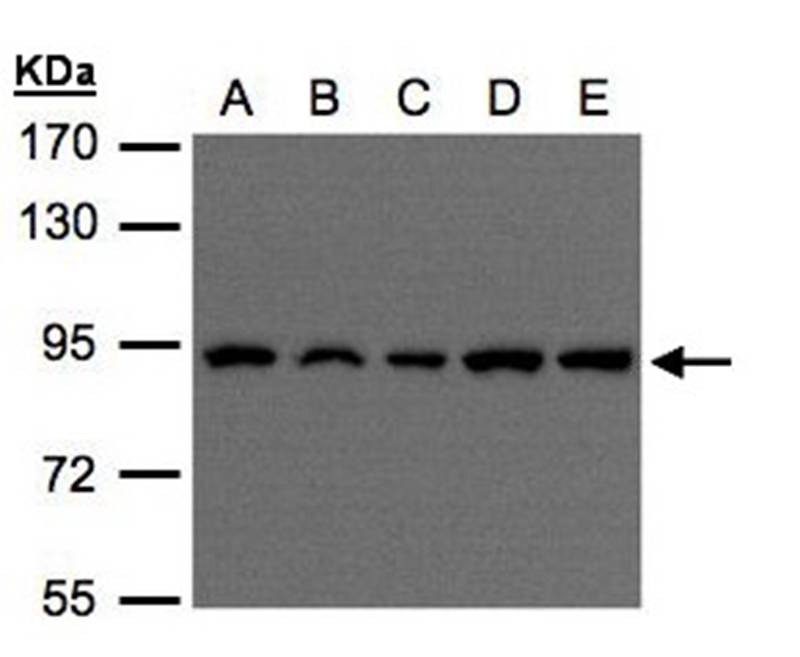 VPS35 antibody - SAB | Signalway Antibody