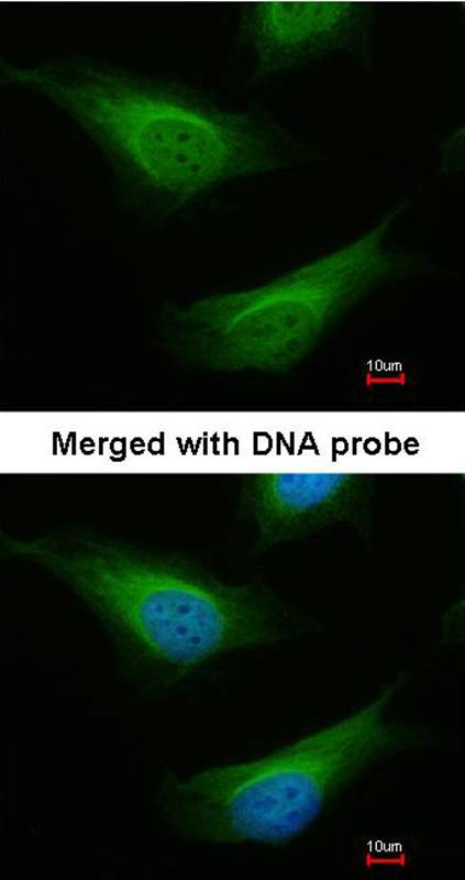 FANCC antibody - SAB | Signalway Antibody