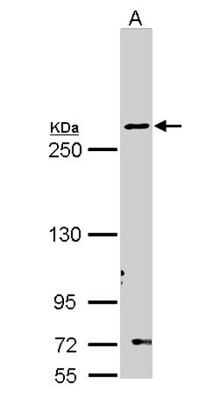 Fatty Acid Synthase antibody