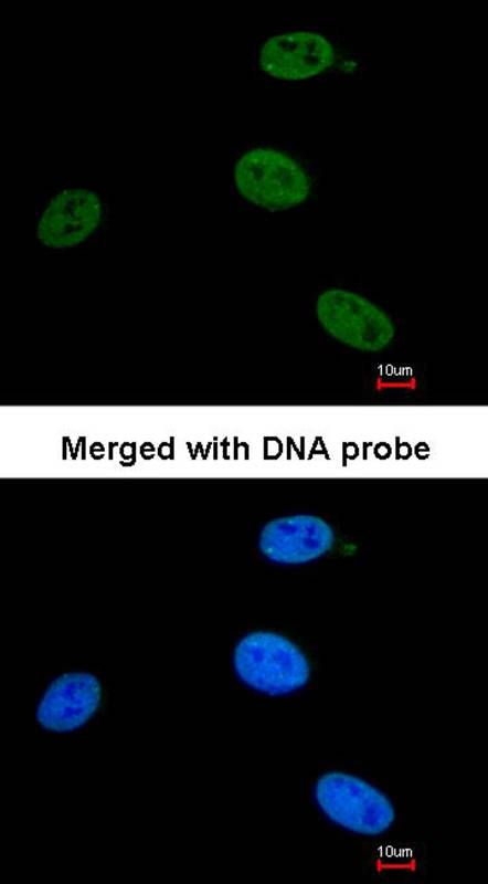 XPB antibody