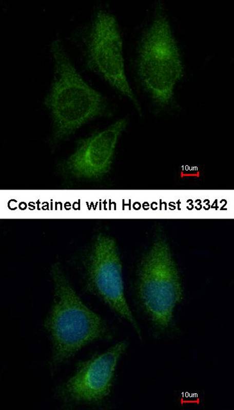 Endothelin 1 antibody