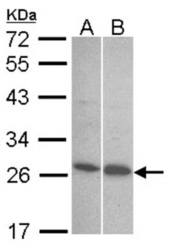 Endothelin 1 antibody